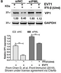 Anti-Enterovirus 71 VP1 antibody used in Western Blot (WB). GTX132338