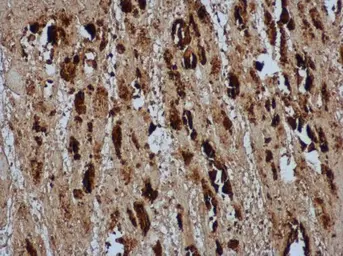 Anti-Enterovirus 71 VP2 antibody used in IHC (Paraffin sections) (IHC-P). GTX132340
