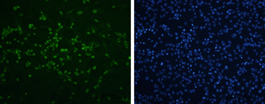 Anti-Enterovirus 71 VP2 antibody used in Immunocytochemistry/ Immunofluorescence (ICC/IF). GTX132340