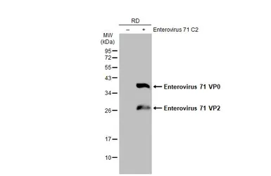 Anti-Enterovirus 71 VP2 antibody used in Western Blot (WB). GTX132340