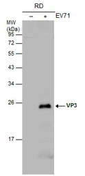 Anti-Enterovirus 71 VP3 antibody used in Western Blot (WB). GTX132341