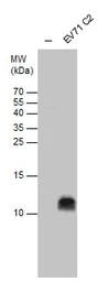 Anti-Enterovirus 71 2B antibody used in Western Blot (WB). GTX132343