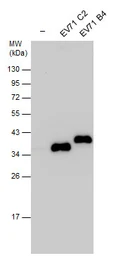 Anti-Enterovirus 71 VP1 antibody used in Western Blot (WB). GTX132600