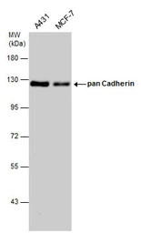 Anti-pan Cadherin antibody used in Western Blot (WB). GTX132646
