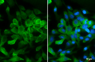 Anti-pan Cadherin antibody used in Immunocytochemistry/ Immunofluorescence (ICC/IF). GTX132646
