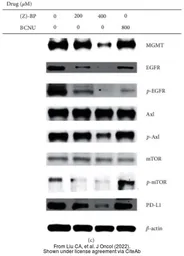 Anti-EGFR (phospho Tyr1068) antibody used in Western Blot (WB). GTX132810