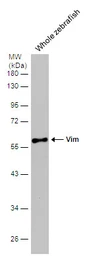 Anti-Vim antibody used in Western Blot (WB). GTX133061