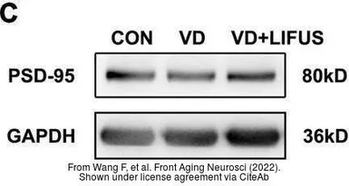 Anti-PSD95 antibody used in Western Blot (WB). GTX133091