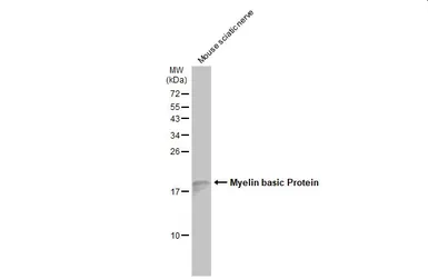 Anti-Myelin basic protein antibody used in Western Blot (WB). GTX133108