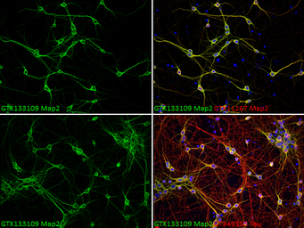 Anti-MAP2 antibody used in Immunocytochemistry/ Immunofluorescence (ICC/IF). GTX133109