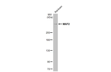 Anti-MAP2 antibody used in Western Blot (WB). GTX133109