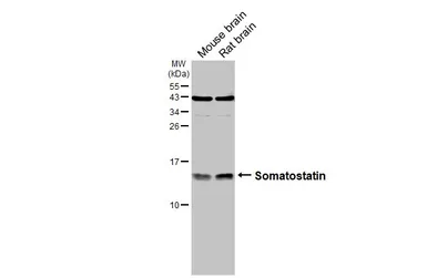 Anti-Somatostatin antibody used in Western Blot (WB). GTX133119