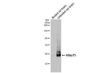 Anti-VGluT1 antibody used in Western Blot (WB). GTX133148