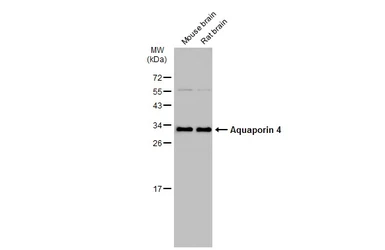 Anti-Aquaporin 4 antibody used in Western Blot (WB). GTX133151