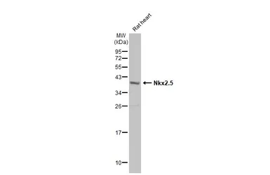 Anti-Nkx2.5 antibody used in Western Blot (WB). GTX133155