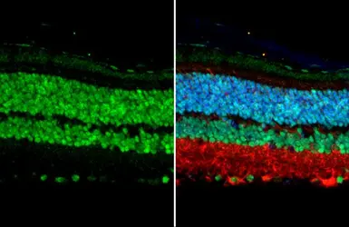 Anti-OTX2 antibody used in IHC (Paraffin sections) (IHC-P). GTX133210