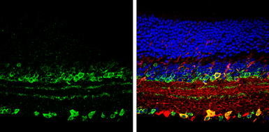 Anti-Vesicular Acetylcholine Transporter antibody used in IHC (Paraffin sections) (IHC-P). GTX133251