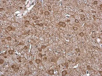 Anti-Vesicular Acetylcholine Transporter antibody used in IHC (Paraffin sections) (IHC-P). GTX133251