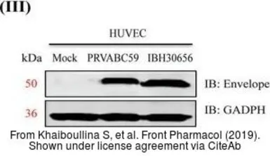 Anti-Zika virus Envelope protein antibody used in Western Blot (WB). GTX133314
