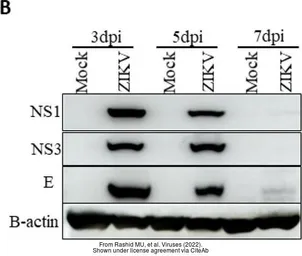 Anti-Zika virus Envelope protein antibody used in Western Blot (WB). GTX133314