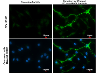 Anti-PDGF Receptor beta (phospho Tyr751) antibody used in Immunocytochemistry/ Immunofluorescence (ICC/IF). GTX133525