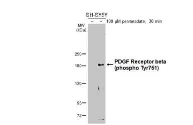 Anti-PDGF Receptor beta (phospho Tyr751) antibody used in Western Blot (WB). GTX133525