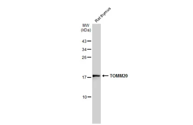 Anti-TOMM20 antibody used in Western Blot (WB). GTX133756