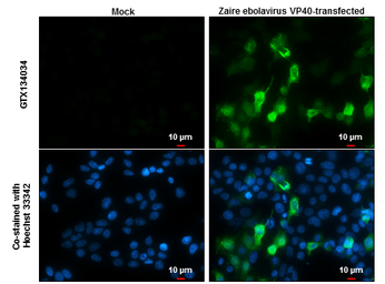 Anti-Ebola virus VP40 antibody used in Immunocytochemistry/ Immunofluorescence (ICC/IF). GTX134034