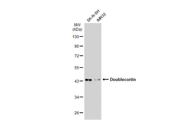 Anti-Doublecortin antibody used in Western Blot (WB). GTX134052