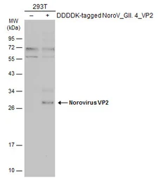 Anti-Norovirus VP2 antibody used in Western Blot (WB). GTX134383