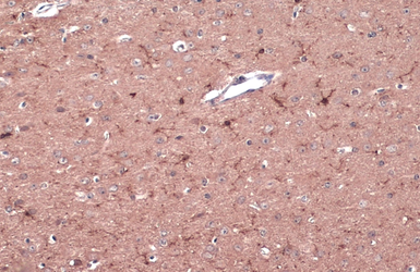Anti-CD11b antibody used in IHC (Paraffin sections) (IHC-P). GTX134493