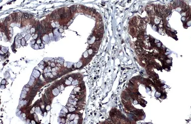 Anti-Thrombospondin 2 antibody used in IHC (Paraffin sections) (IHC-P). GTX134554