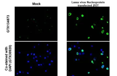 Anti-Lassa virus Nucleoprotein antibody used in IHC-P (cell pellet) (IHC-P (cell pellet)). GTX134873