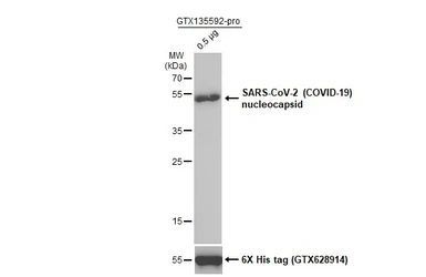 SARS-CoV-2 (COVID-19) Nucleocapsid protein, His tag. GTX135592-pro