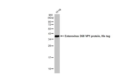 Enterovirus D68 VP1 protein, His tag. GTX138561-pro
