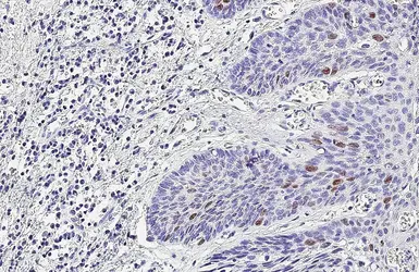 Anti-Ki67 antibody [SP6] used in IHC (Paraffin sections) (IHC-P). GTX16667