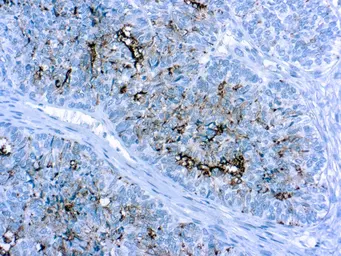 Anti-CA125 antibody [OV185:1] used in IHC (Paraffin sections) (IHC-P). GTX20697