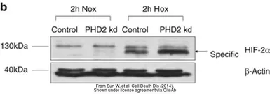 Anti-HIF2 alpha antibody used in Western Blot (WB). GTX30114