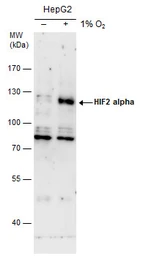 Anti-HIF2 alpha antibody used in Western Blot (WB). GTX30114