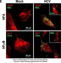 Anti-Hepatitis C virus Core Antigen antibody [11-B3] used in Immunocytochemistry/ Immunofluorescence (ICC/IF). GTX41722