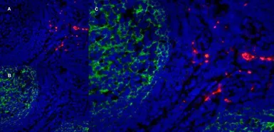 Anti-CD163 antibody [EDHu-1] used in IHC (Frozen sections) (IHC-Fr). GTX42365
