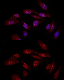 Anti-EIF6 antibody used in Immunocytochemistry/ Immunofluorescence (ICC/IF). GTX54010