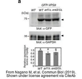 Anti-GAPDH antibody [GT239] used in Western Blot (WB). GTX627408