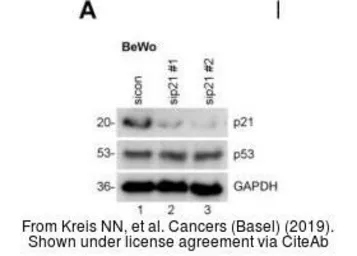 Anti-GAPDH antibody [GT239] used in Western Blot (WB). GTX627408