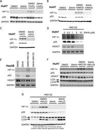 Anti-GAPDH antibody [GT239] used in Western Blot (WB). GTX627408