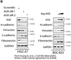 Anti-GAPDH antibody [GT239] used in Western Blot (WB). GTX627408