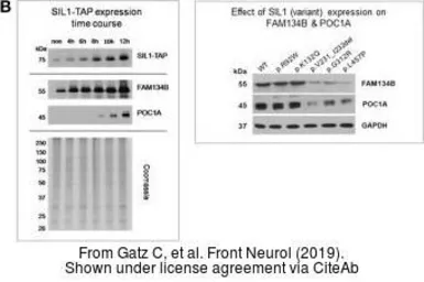 Anti-GAPDH antibody [GT239] used in Western Blot (WB). GTX627408