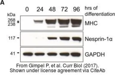 Anti-GAPDH antibody [GT239] used in Western Blot (WB). GTX627408