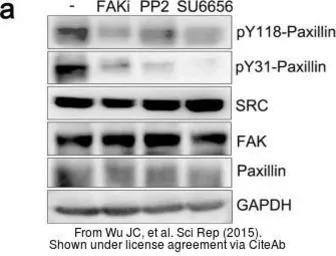 Anti-GAPDH antibody [GT239] used in Western Blot (WB). GTX627408