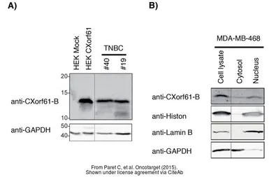 Anti-GAPDH antibody [GT239] used in Western Blot (WB). GTX627408